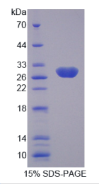 激肽释放酶4(KLK4)重组蛋白