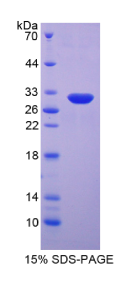 整合素β5(ITGβ5)重组蛋白