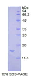 复合素2(CPLX2)重组蛋白