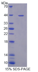 巨噬细胞炎性蛋白1β(MIP1β)重组蛋白