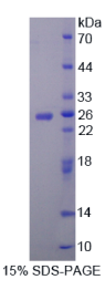 烟碱型胆碱受体α4(CHRNα4)重组蛋白