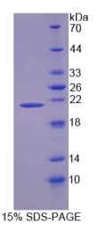 酶原粒蛋白16同源物B(ZG16B)重组蛋白