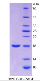 膜联蛋白A2(ANXA2)重组蛋白