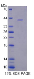 含NLR家族Pyrin域蛋白3(NLRP3)重组蛋白