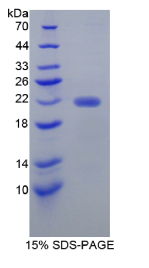 纤维胶凝蛋白2(FCN2)重组蛋白