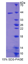 巨噬细胞炎性蛋白3β(MIP3β)重组蛋白