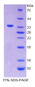 膜联蛋白A5(ANXA5)重组蛋白