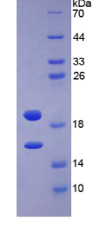 碱性成纤维细胞生长因子(FGF2)重组蛋白
