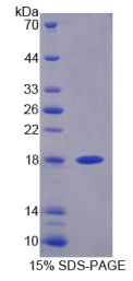 双特异性磷酸酶5(DUSP5)重组蛋白