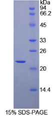 热休克蛋白β2(HSPβ2)重组蛋白