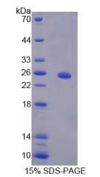 赫曼斯基普德拉克综合征蛋白4(HPS4)重组蛋白