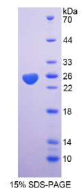 透明质酸结合蛋白1(HABP1)重组蛋白