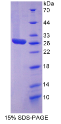 生长关联蛋白43(GAP43)重组蛋白