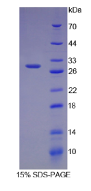 腱蛋白(CHRD)重组蛋白
