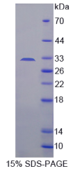 解整合素金属蛋白酶33(ADAM33)重组蛋白