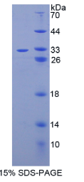 胱天蛋白酶14(CASP14)重组蛋白