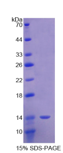 信号素3E(SEMA3E)重组蛋白