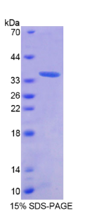 抗酶抑制因子1(AZIN1)重组蛋白