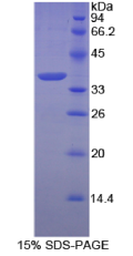 膜联蛋白A5(ANXA5)重组蛋白