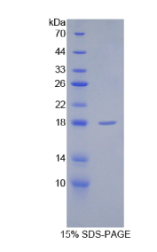 分泌型卷曲相关蛋白1(SFRP1)重组蛋白