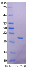 生长分化因子9(GDF9)重组蛋白