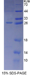 免疫球蛋白超家族成员16(IGSF16)重组蛋白