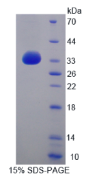 整合素β4(ITGβ4)重组蛋白