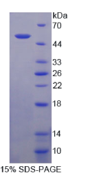 分泌跨膜蛋白1(SECTM1)重组蛋白