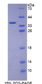 角蛋白1(KRT1)重组蛋白