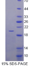 微管关联蛋白1轻链3α(MAP1LC3α)重组蛋白