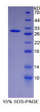 细胞因子信号转导抑制因子3(SOCS3)重组蛋白