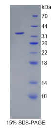 无翅型MMTV整合位点家族成员10B(WNT10B)重组蛋白