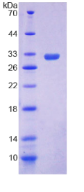 纤维胶凝蛋白1(FCN1)重组蛋白