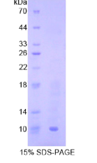 巨噬细胞炎性蛋白3β(MIP3β)重组蛋白