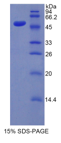 激肽释放酶7(KLK7)重组蛋白