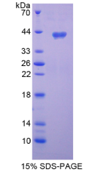 趋化因子C-C-基元配体3样蛋白1(CCL3L1)重组蛋白