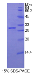 原钙黏素β2(PCDHβ2)重组蛋白