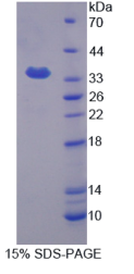 含KH域RNA结合信号通路关联蛋白1(KHDRBS1)重组蛋白