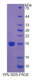 双特异性磷酸酶5(DUSP5)重组蛋白