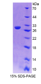 激肽释放酶4(KLK4)重组蛋白