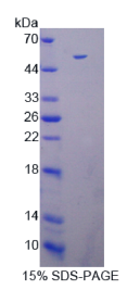 死亡关联蛋白激酶3(DAPK3)重组蛋白