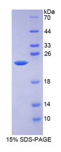 醛脱氢酶9家族成员A1(ALDH9A1)重组蛋白