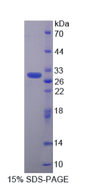 钙周期素结合蛋白(CACYBP)重组蛋白