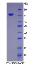 嗜铬蛋白B(CHGB)重组蛋白