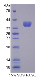 原钙黏素β16(PCDHβ16)重组蛋白