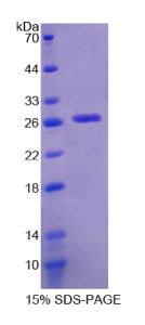 谷胱甘肽S转移酶θ2(GSTθ2)重组蛋白