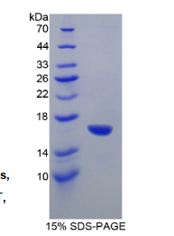 谷氨酸脱羧酶1(GAD1)重组蛋白
