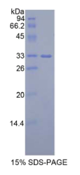 胰岛素样生长因子2-mRNA结合蛋白2(IGF2BP2)重组蛋白