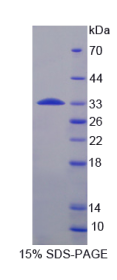 核糖体蛋白S6激酶β1(KL6Kβ1)重组蛋白