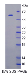 含IQ基元GTP酶激活蛋白1(IQGAP1)重组蛋白